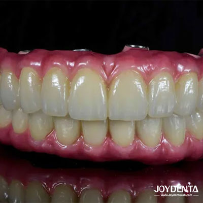 Beli Jembatan Hibrida Titanium Dental Ringan Nyaman Untuk Restorasi Gigi pembuatan online