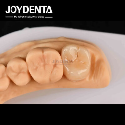 Beli Kekuatan tinggi Emax Inlay Onlay A2 Warna tahan lama untuk restorasi gigi yang rusak pembuatan online