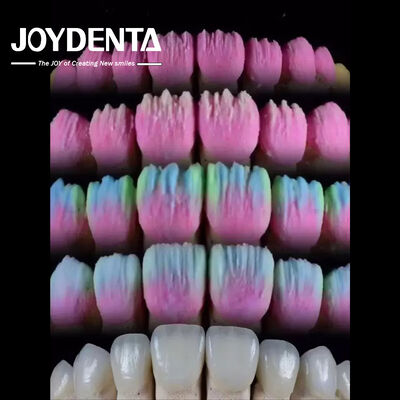 Beli The Joydenta Ceramic Veneer Process pembuatan online