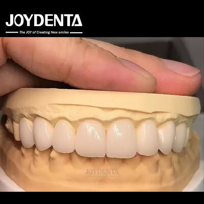 Beli 16 Nuansa Warna Emax Dental Veneers A1-A4 Ketahanan terhadap noda yang tinggi untuk senyum yang sempurna pembuatan online