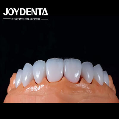Beli A1-A4 Ips Emax Press Porselen Dental Veneers tahan noda Bentuk yang dapat disesuaikan pembuatan online