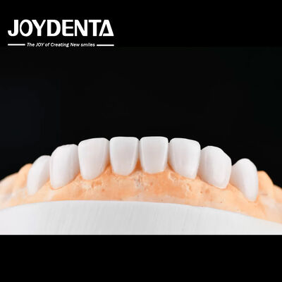 Beli Enhance Case Acceptance & Patient Communication with Our Diagnostic Wax-Up Service pembuatan online