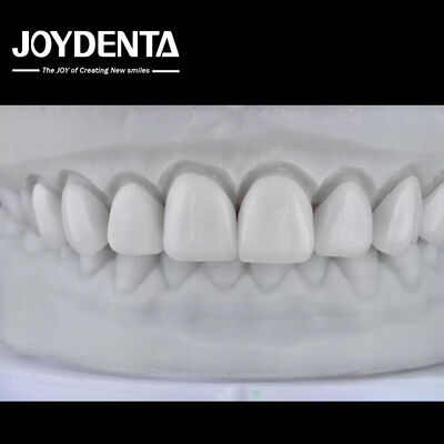 Beli Visualize the Result, Secure the Case: Our Diagnostic Wax-Up Service pembuatan online