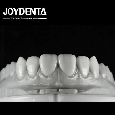 Beli Natural Color Dental Wax Up Solusi serbaguna untuk restorasi satu atau beberapa gigi pembuatan online