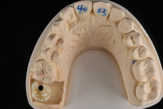 Berkualitas Profesional Dental Zirconia Hybrid Imitasi Bahan Permukaan halus atau kasar