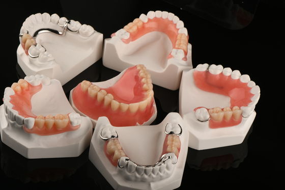 Hypoallergenic Acrylic Dental Removables Gigi buatan Gigi removable parsial