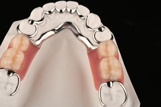 Dental parsial akrilik tahan noda untuk kenyamanan alami mengganti gigi yang hilang