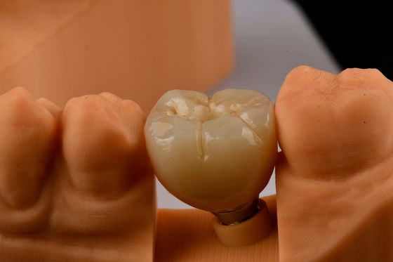 Oral Implantology Self Tapping Single Tooth Dental Implants dengan Internal Hex Connection
