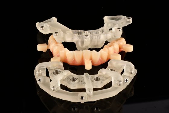 Titanium Static Guided Surgery Solutions Untuk Terapi Implan Sangat Tepat
