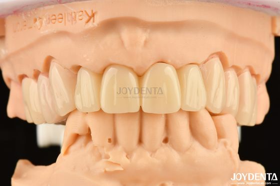 Biokompatibel PMMA M75 Restoration Resistant Scratch Untuk Estetika Gigi