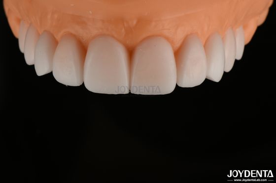 Diagnosa yang halus dan replikasi FDA, Full Arch Teeth Wax Up sangat akurat