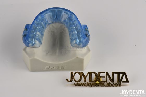 Custom Fitted Adjustable Anti Snoring Mouthpiece / Snore Mouthguard Sepanjang Malam