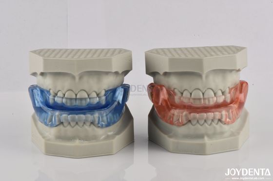 Alat Bantuan Tidur yang Cocok dengan Custom Mouthpieces Alat Gigi Untuk Menghentikan Mendengkur