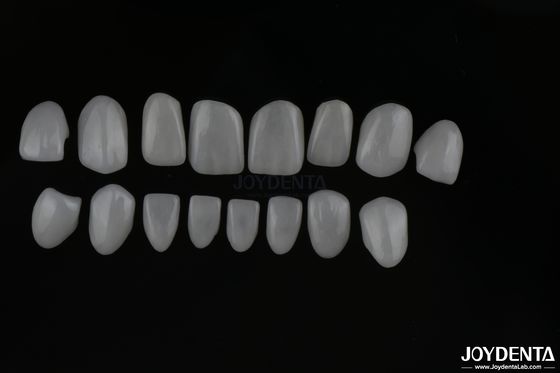 Benar-benar terlihat kaca keramik veneers gigi dengan permukaan berkilau atau matte akhir