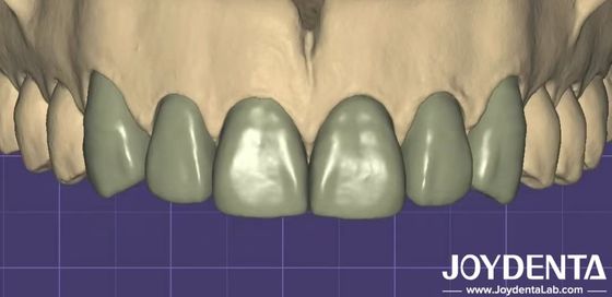 Percetakan 3D Virtual Digital Wax Up Kompatibilitas dengan perangkat lunak gigi lainnya