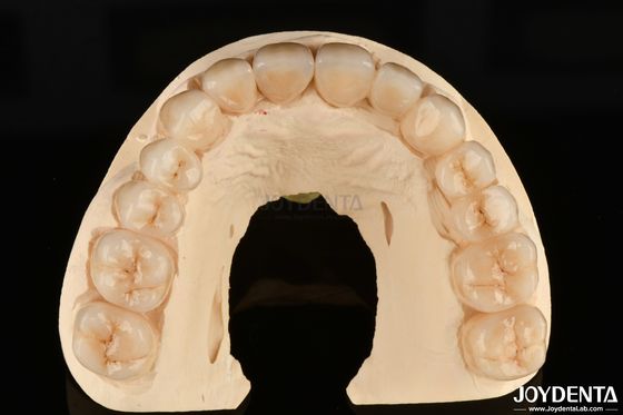 Ketahanan Korosi Tinggi Zirkonia Lengkap Bahan yang Diutamakan untuk Restorasi Gigi Putih