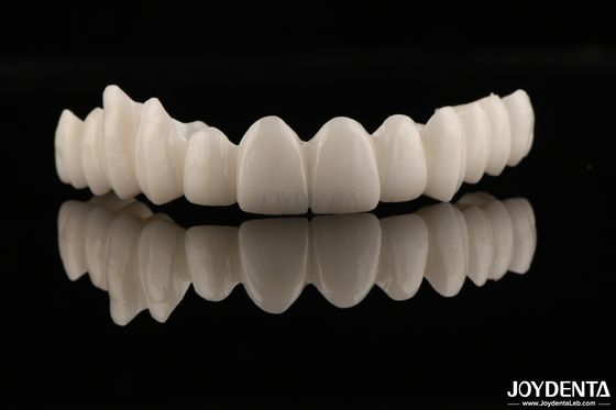 Estetika Tinggi Full Zirconia Ketahanan Tinggi terhadap Korosi Dan Pakai untuk Aplikasi yang Mengharukan