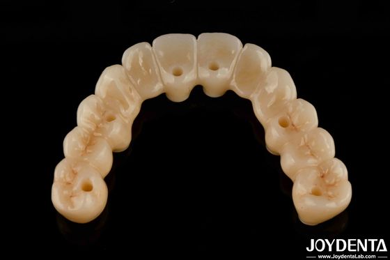 High Flexibility Zirconia Hybrid Bridge Dengan Titanium Base