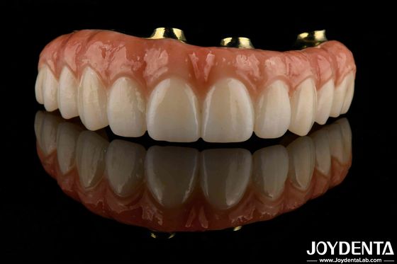 Nyaman Pakai Titanium Bar Zirconia Hybrid Bridge Biokompatibilitas Tinggi Panjang