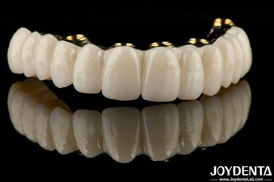 Jembatan Implantasi Zirconia Hibrid Lurus Memulihkan Fungsi Mengunyah Custom Made