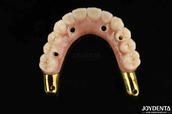 Pakai tahan Zirconia Hybrid Jembatan Dengan Ti-Bar Kompatibel Natural Gigi Dan Gusi