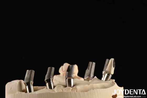 Custom Made Polished Titanium Abutment Cement Retetion Jenis benang berbentuk V