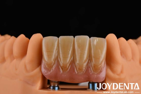 4.5mm Tinggi Abutments Selesai Jenis Sambungan Hex Internal Kompatibel dengan Sistem Implant