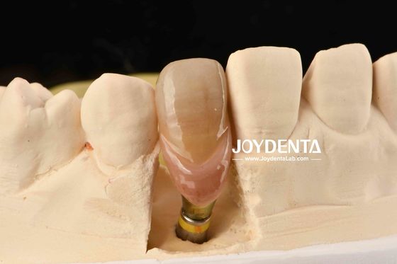 0° Angulasi Abutment Gigi Selesai 1.5mm Thread Pitch Permukaan yang dipoles