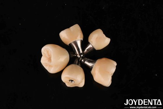 Sekrup Retesi Titanium Abutments Internal Hex Connection Untuk Implan Gigi