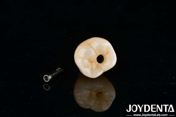 Internal Hex Titanium Implant Dental Precision Machining dengan Zero Angulation