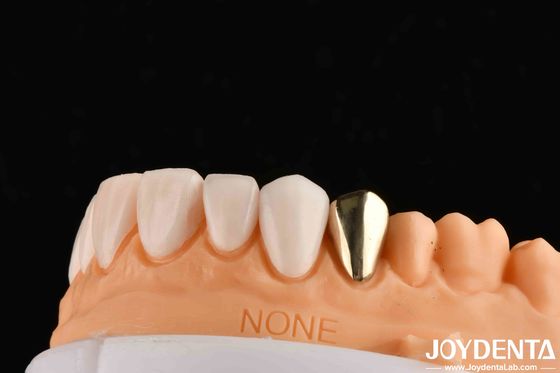 Wax Cast Gold 60K Metallic Dental Crowns Abrasive Resistant Gold Tooth Crown