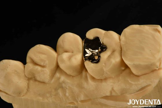 Clinical Metallic Dental Gold Crown 60K Gold Tooth Cap Untuk Rehabilitasi Oral
