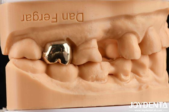 Abrasi Resistant Wax Casting Dental Materials for Enhanced Oral Rehabilitation