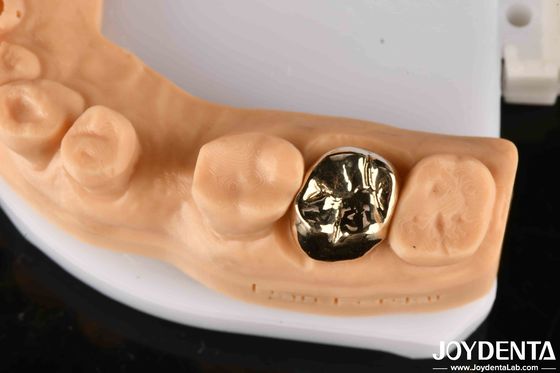 Bahan logam Dental emas mahkota, emas mahkota gigi untuk rehabilitasi optimal mulut