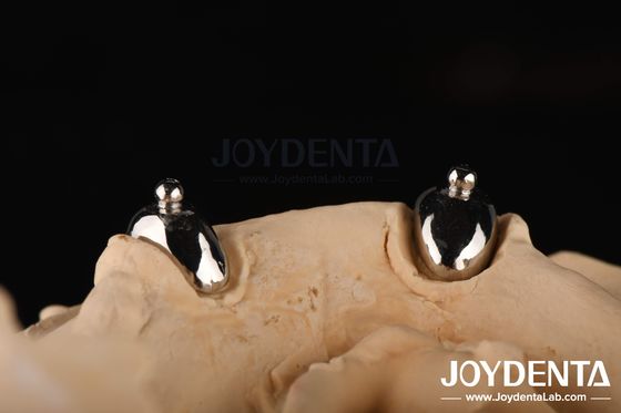 Joydental laboratorium gigi Ball Attachment