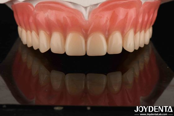 Acrylic Teeth Finish Bahan resin ringan Restorasi gigi Pengaturan gigi