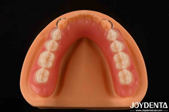 Personalize Denture Akrilik Finish Ringan Elastisitas Tinggi