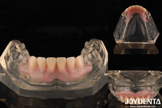 Teknologi Pengaturan Gigi Fleksibel Denture Finish Elastisitas Tinggi
