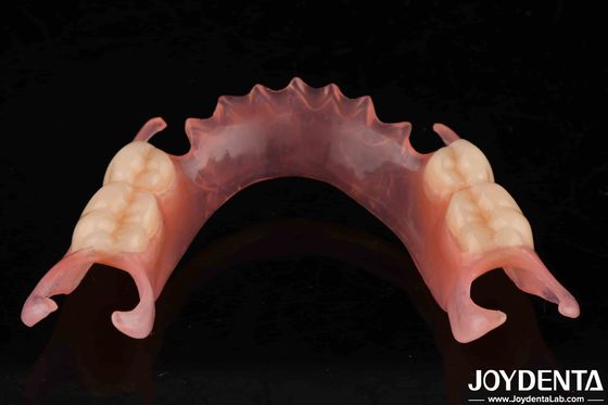 Dental Flexible Denture Finish Dengan High Stealth Berbagai Bahan