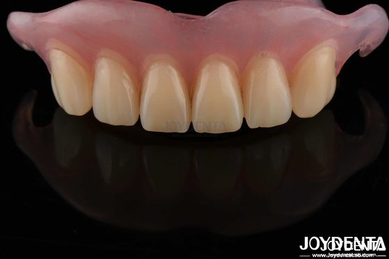 High Stealth Flexible Removable Denture Selesai Nyaman Fit Dental Lab