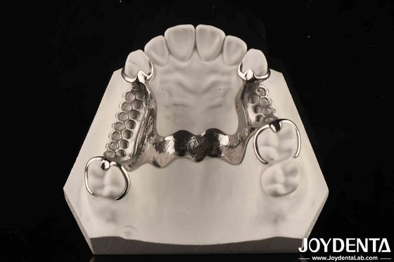 Praktek Klinis Dental Paduan Kerangka Logam Good Fit In The Mouth Teknologi
