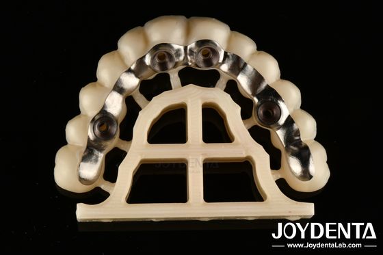 Silver Finish Custom Abutments And Bares Precise Fit Screw Dipegang Atau Semen Dipegang