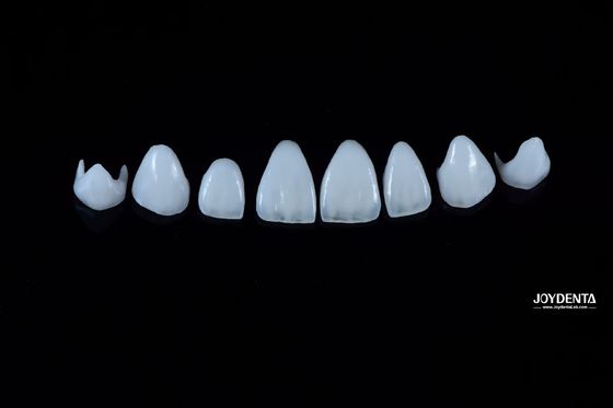0.3-0.5mm tebal Porselen alami Emax veneers kekuatan tinggi tahan lama untuk estetika