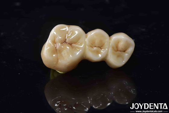 Biokompatibilitas Tinggi Zirconia Full Contour Crown Perfect Fit Kekuatan Tinggi