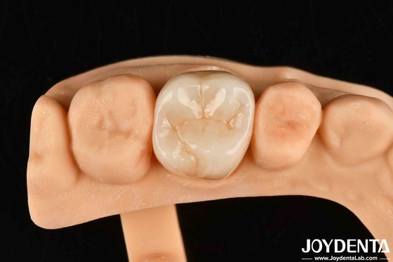 High Wear Resistance Dental Full Zirconia Kekuatan Tinggi Full Contour Zirconia Bridge