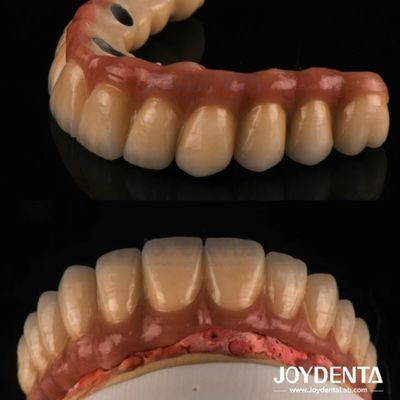 Pembuangan dan penggilingan PFM Dental Crown, restorasi gigi Porcelain Fused Metal Crown