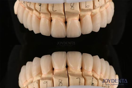 Zirconia Gigi Lapisan yang Dipolesi Ketebalan 0,3-0,5mm Dengan Teknologi CAD CAM