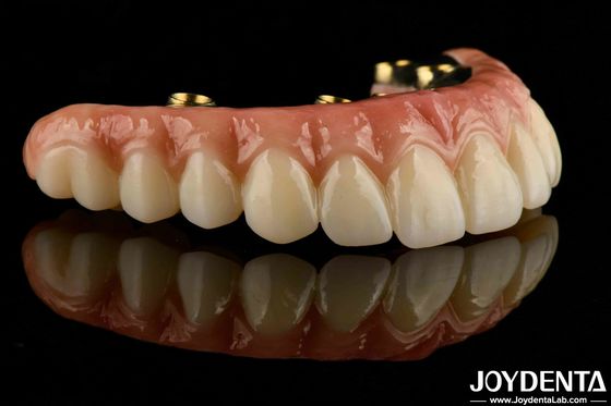 Dilengkapi khusus untuk setiap pasien Ti-Bar Zirconia Hybrid Bridge untuk gigi palsu yang tahan lama