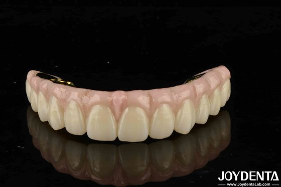 Ketahanan Tinggi Zirconia Solusi Utama Untuk Gigi Alam Dan Kompatibilitas Gusi