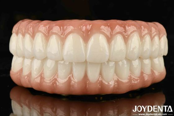 High Biocompatibility Ti-Bar Zirconia Hybrid Bridge Untuk Pas Tepat Dan Ganti Gigi Yang Hilang